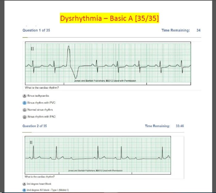 Relias dysrhythmia advanced b test answers