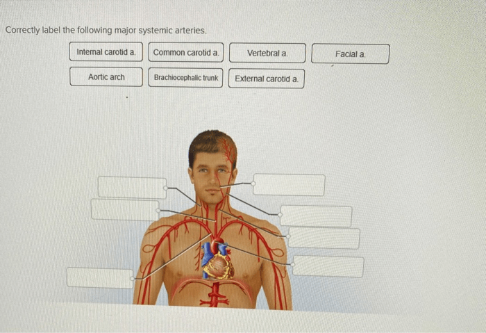 Correctly label the following major systemic arteries.