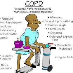 Nursing care complex oxygenation alterations